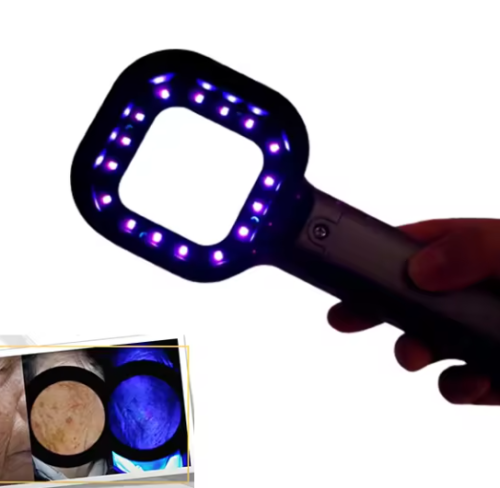 Wood'a GLOBLIGHT lamp (Wood's lamp) skin diagnostics Ultraviolet light (UV)